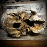 Human skull