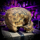 Human skull