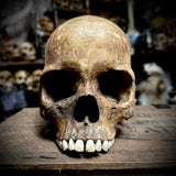 Human skull