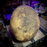 Human skull