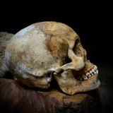 Large human skull with mandible