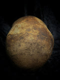 Human skull