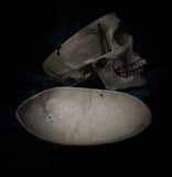 Medically prepared human skull