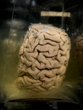 A human brain