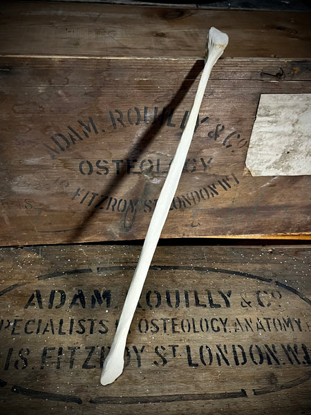 Human fibula (lower leg bone)