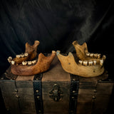 Item 7. A pair of human mandibles