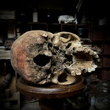 Human Skull