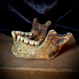 Item 9. Human mandible