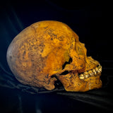 Item 9. Human skull with mandible