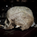 Human skull
