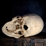 Item 5. Human medical skull