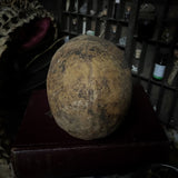 Human skull