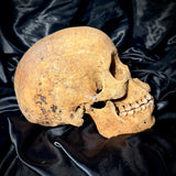Item 15. Human skull with mandible