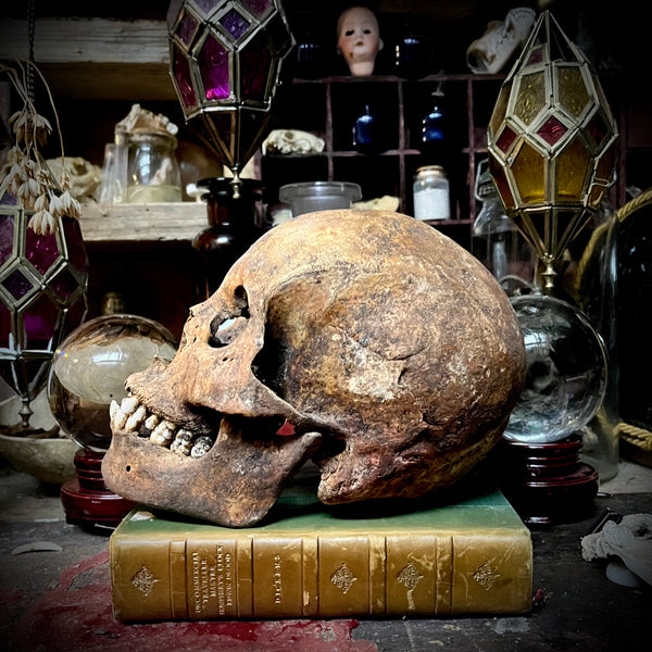 A human skull with mandible