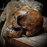 Human skull with mandible