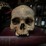 Human skull