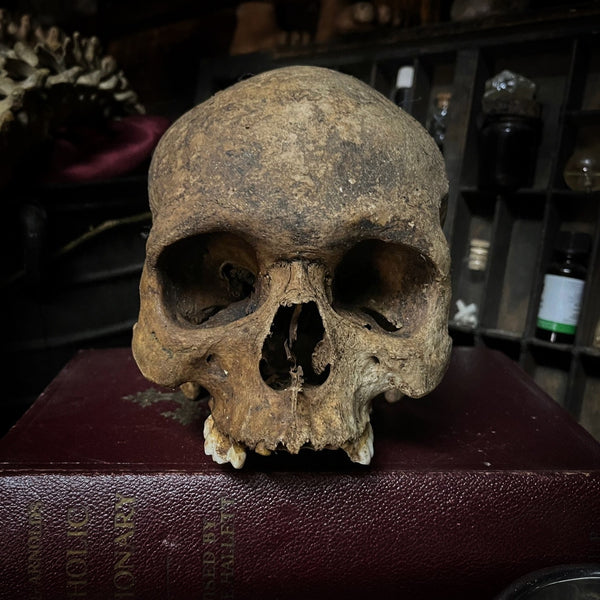 Human skull