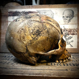 Human skull