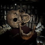 Human skull