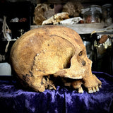 Human skull