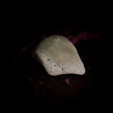 Adam Rouilly Human Kneecap