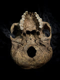 Human skull