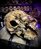 Human skull