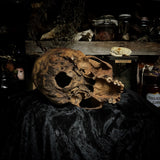 Human skull