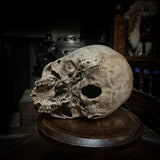 Human child skull