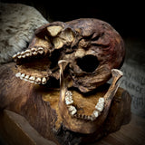 Human skull with mandible