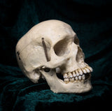 Medically prepared human skull