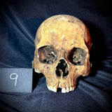 Item 9. Human skull