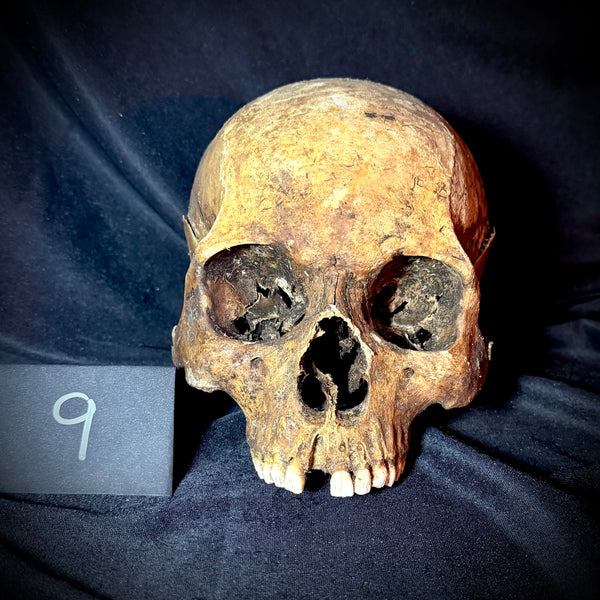 Item 9. Human skull