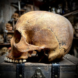 Human skull