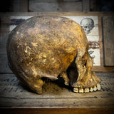 Human skull