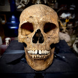 Human skull with mandible