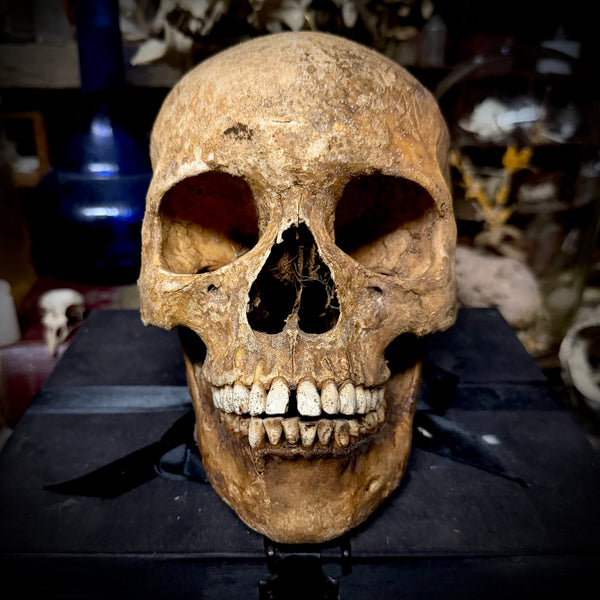 Human skull with mandible