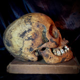 Item 20. Human skull with mandible