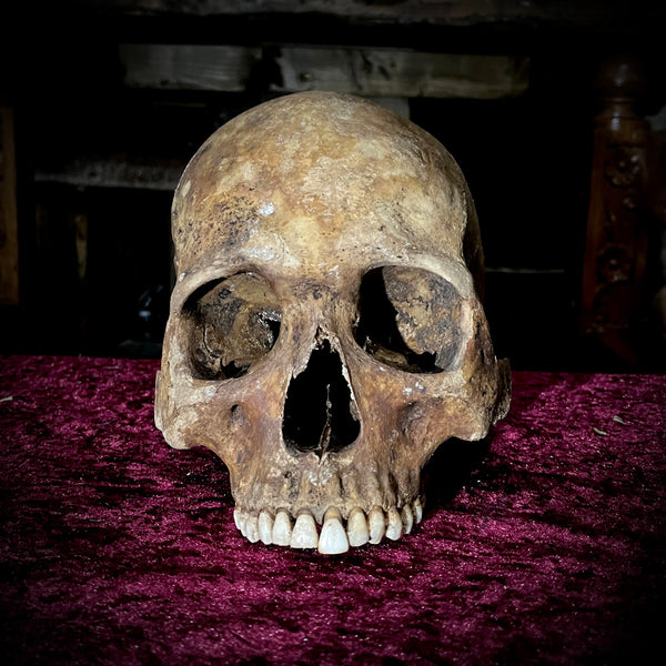 Human skull