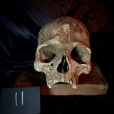 Item 11. Human skull