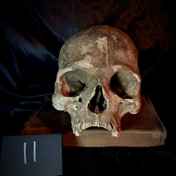 Item 11. Human skull