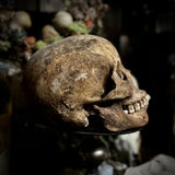 A human skull with mandible