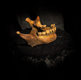 A mandible