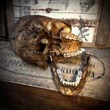 Human skull with mandible