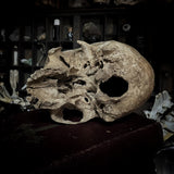 Human skull