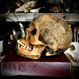 Human skull with mandible