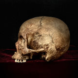 Human Skull