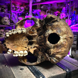 Human skull