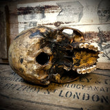 Human skull