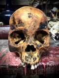 Human skull